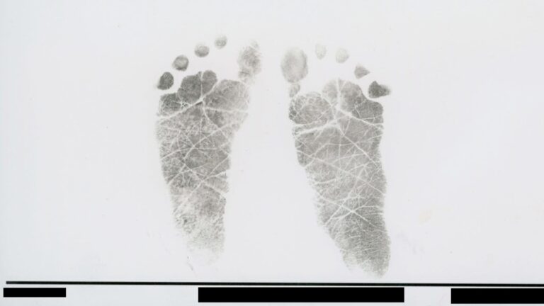 What we learned about vitamin K deficiency from baby autopsy reports — ProPublica